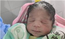 4گوشه دنیا/ تولد نوزادی بدون پوست با موهای سفید در مصر!