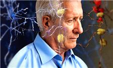 چطور از بیماری آلزایمر جلوگیری کنیم؟