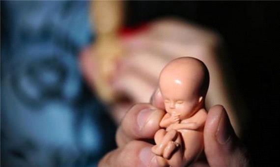 ارتباط بین سقط جنین با مرگ زودهنگام زنان