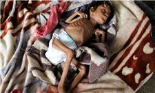 زنان و کودکان؛ قربانیان بحران انسانی در یمن