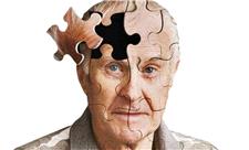 با علائم بیماری آلزایمر آشنا شوید