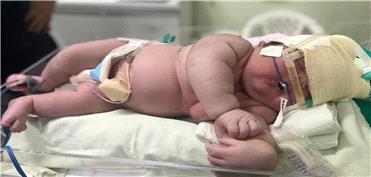4گوشه دنیا/ تولد نوزادی 7 کیلوگرمی با 60 سانتیمتر قد در برزیل!
