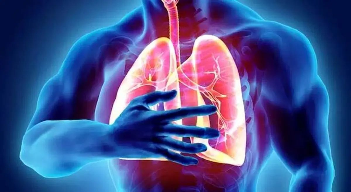 پنوموکوک، سپر تازه کودکان ایرانی در برابر عفونت های ریوی