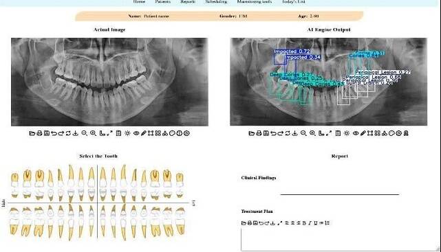 توسعه سامانه هوشمند تحلیل تصاویر دندانپزشکی در دانشگاه تهران