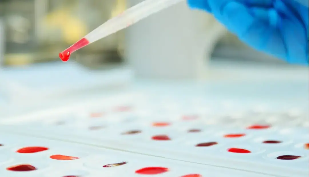 خون طلایی؛ فقط ۵۰ نفر صاحب نادرترین گروه خونی دنیا هستند