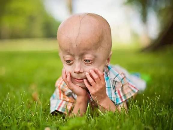 کشف نشانه‌ روانی عجیب از پیری زودهنگام در کودکان