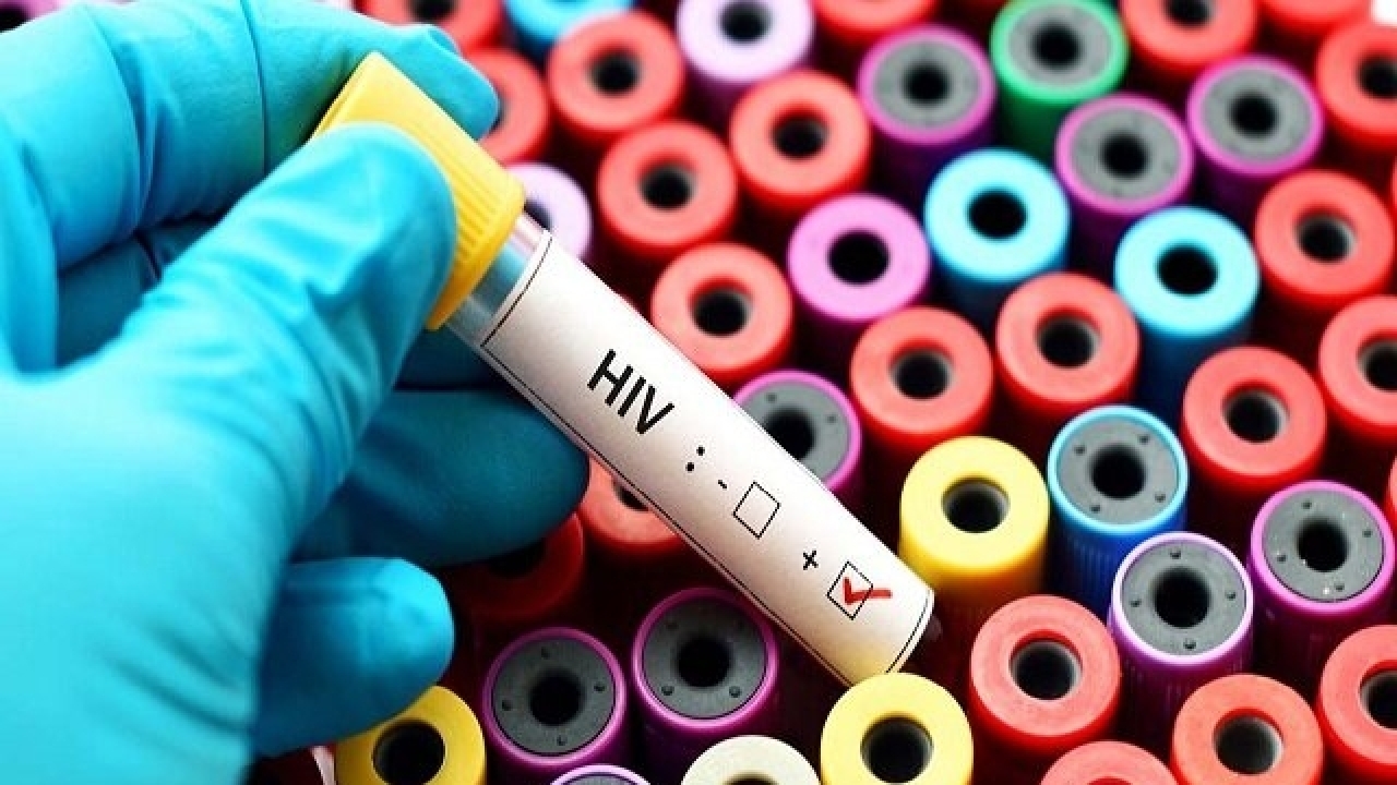 آماری از مبتلایان به ویروس HIV در کشور
