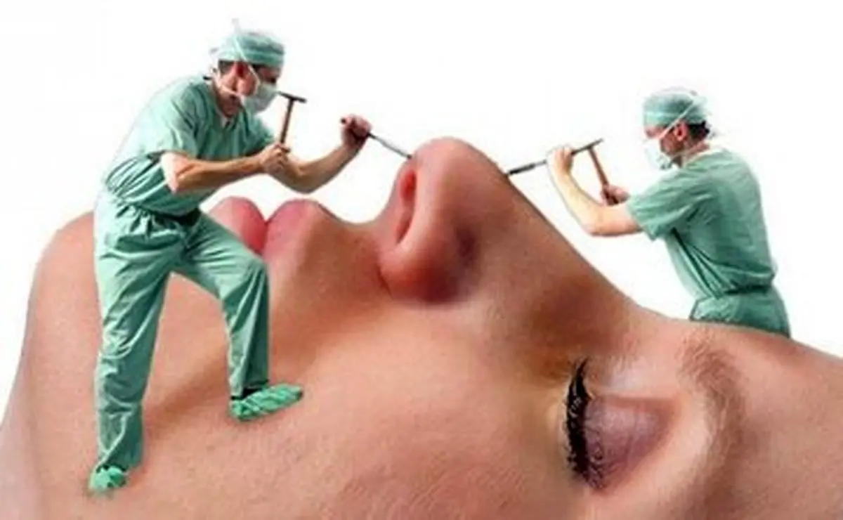 چرا شیادها در بازار جراحی زیبایی کاسبی شان پررونق است؟