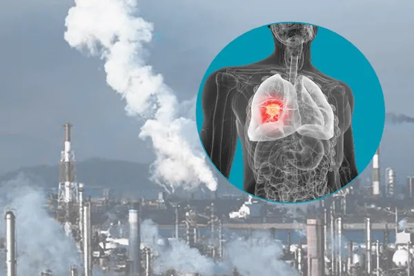 نقش پنهان آلودگی هوا در افزایش خطر سرطان