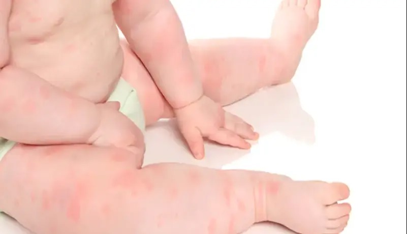 پوست کودک حرف می‌زند