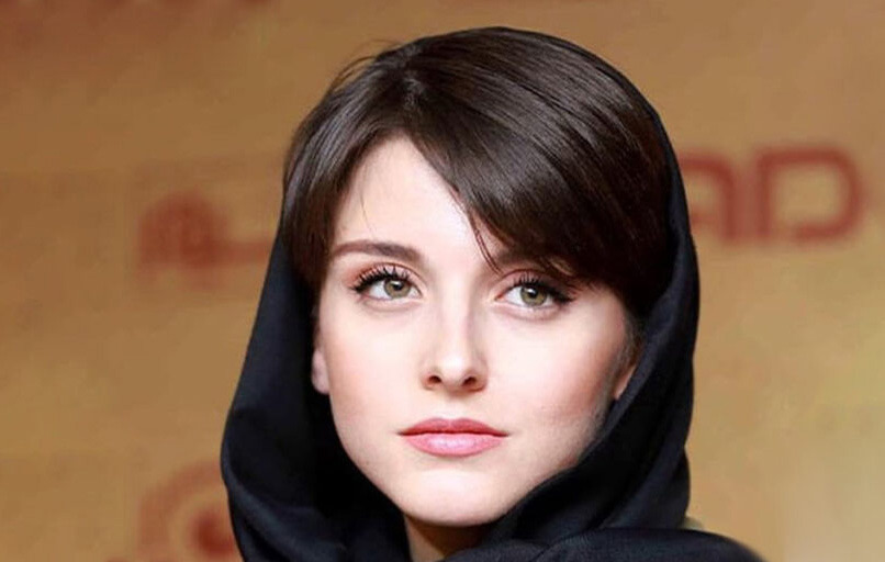 بازیگر زخم کاری با این استایل همه را سورپرایز کرد