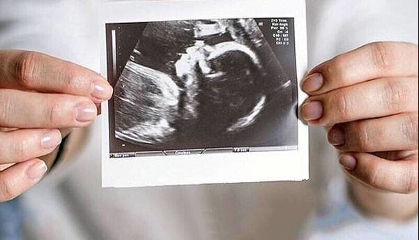 زنان تا چه سنی می‌توانند صاحب فرزند شوند؟