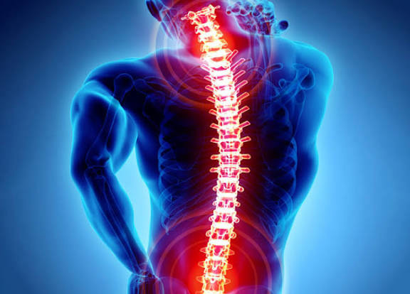 عوامل کمردرد؛ از ژنتیک تا ورزش‌های غیراستاندارد!