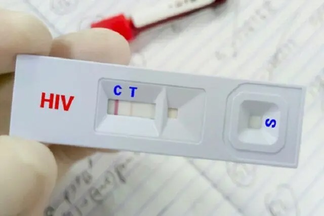 کاهش سهم «اعتیاد» در انتقال HIV؛ توضیح وزارت بهداشت درباره تغییر الگوی انتقال بیماری