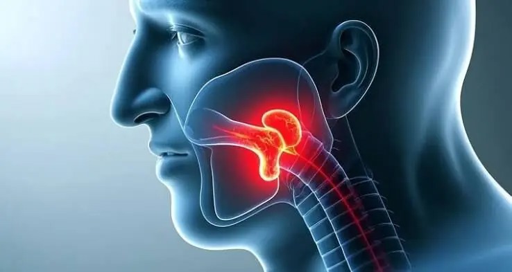 سوزش گلو؛ ۸ علت احتمالی و راه های تسکین آن
